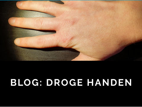 FIBROMEN STEELWRATJES BLOG: DROGE HANDEN